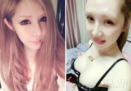 美容医院泄露黄海波事件女主角整形照引发质疑